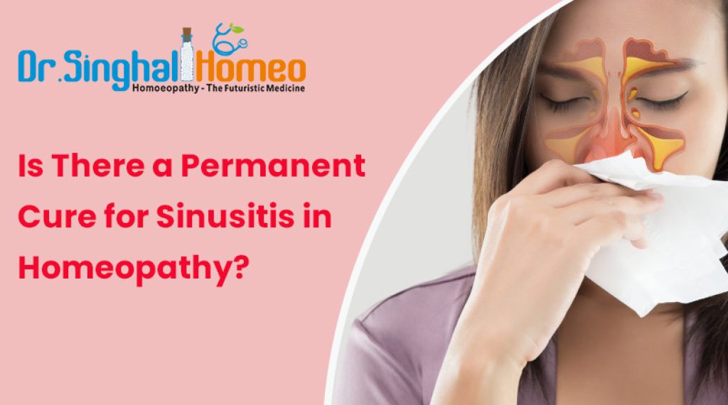 Is There a Permanent Cure for Sinusitis in Homeopathy?