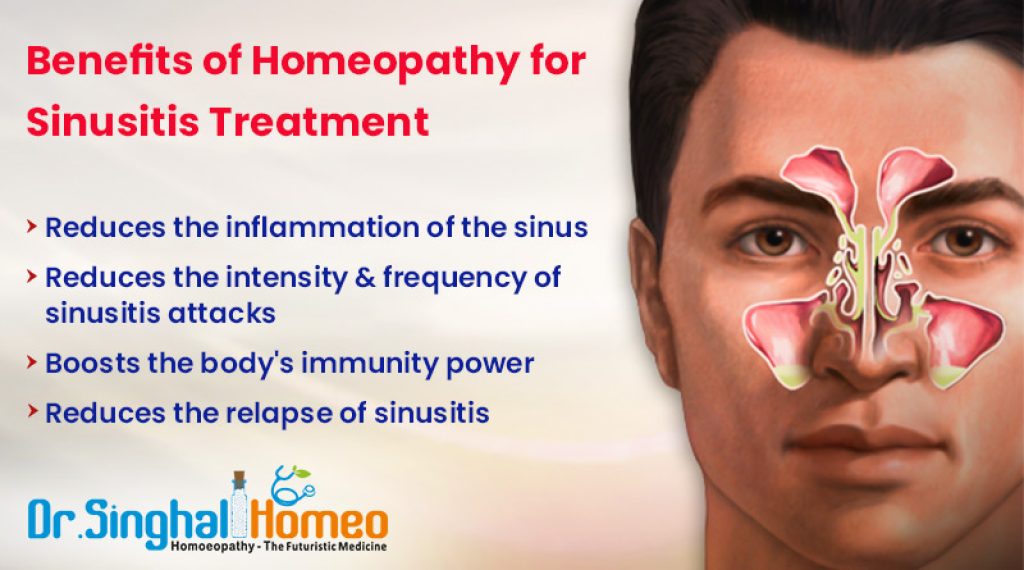 Homeopathic Treatment for Sinusitis