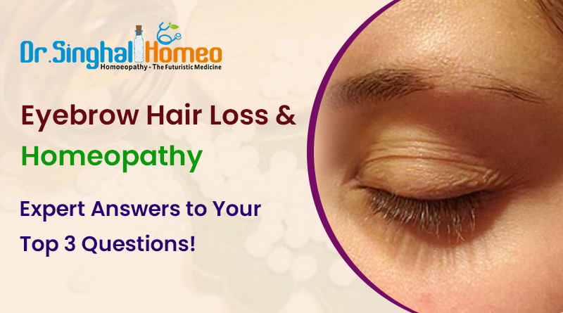 Homeopathic Medicine for Eyebrow Hair Loss Treatment