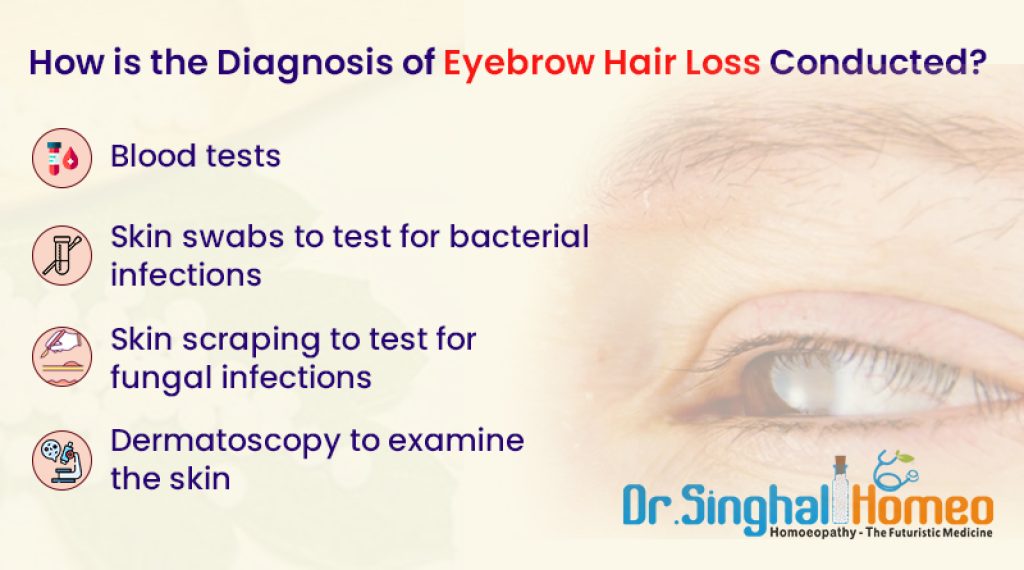 Eyebrow Hair Loss Treatment in Homeopathy